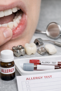 Allergie bei Zahnersatz: Ursachen, Symptome und gut verträgliche Alternativen